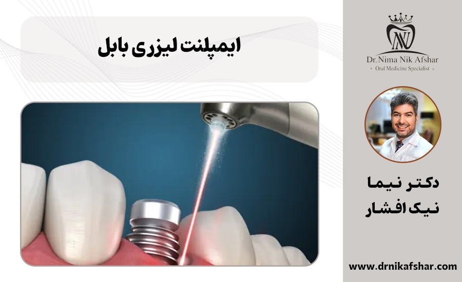 ایمپلنت لیزری بابل