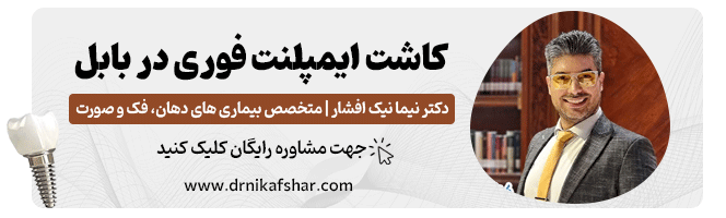 تماس با متخصص ایمپلنت فوری در بابل