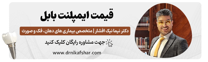 اطلاع از قیمت ایمپلنت دندان در بابل