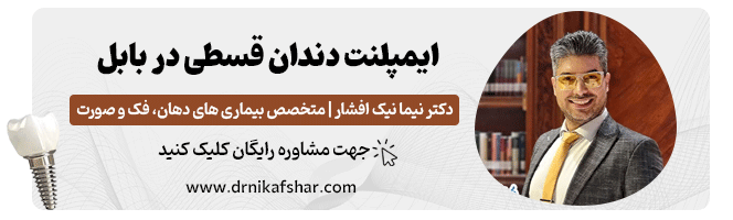 ایمپلنت دندان قسطی در بابل
