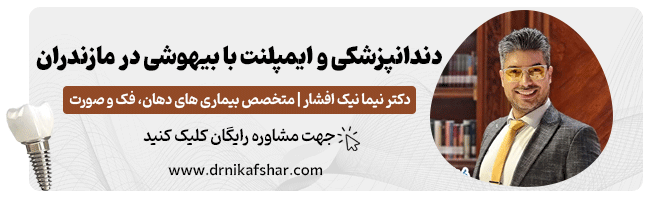 مشاوره و نوبت دهی دندانپزشکی و ایمپلنت با بیهوشی در مازندران