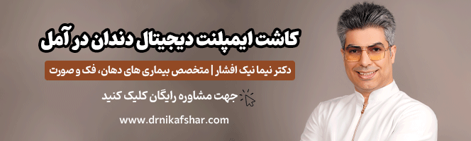 کاشت ایمپلنت دیجیتال دندان در آمل