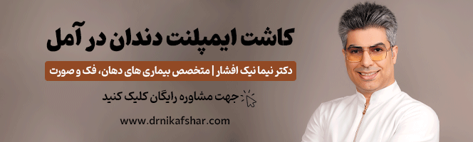 کاشت ایمپلنت دندان در آمل