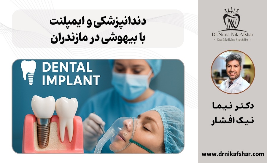 دندانپزشکی و ایمپلنت با بیهوشی در مازندران