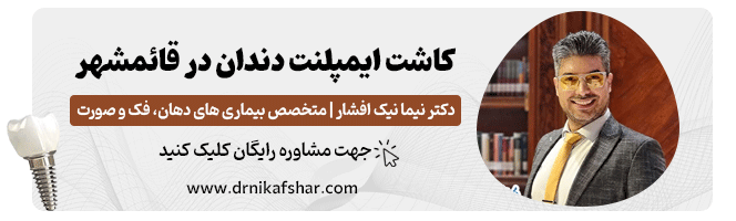 کاشت ایمپلنت دندان در قائمشهر
