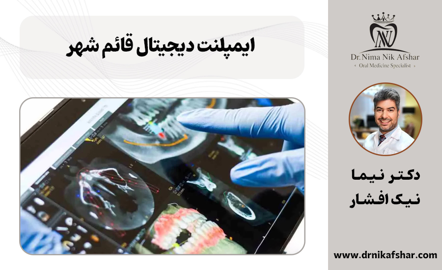 ایمپلنت دیجیتال قائمشهر