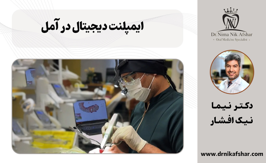 ایمپلنت دیجیتال در آمل
