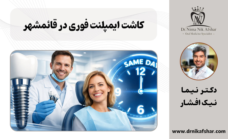کاشت ایمپلنت فوری در قائمشهر