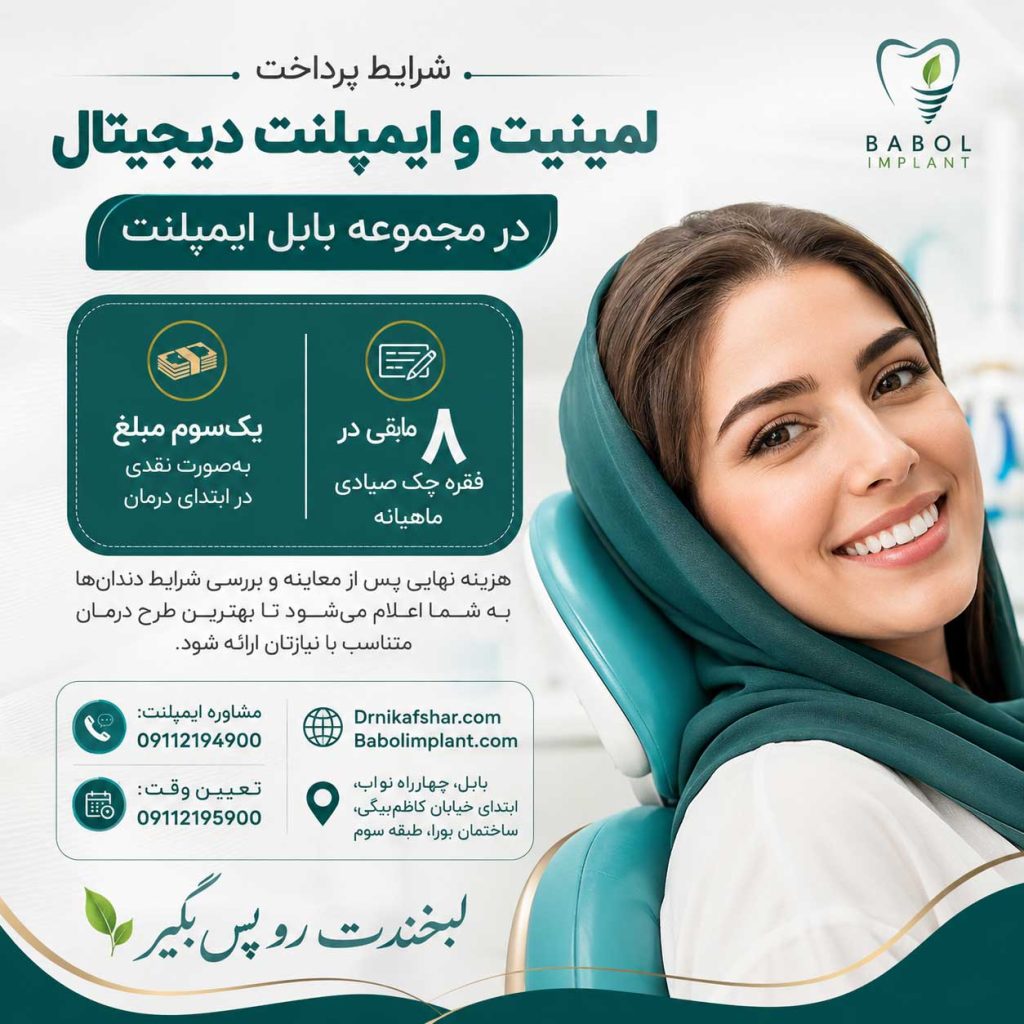 ایمپلنت اقساطی در بابل