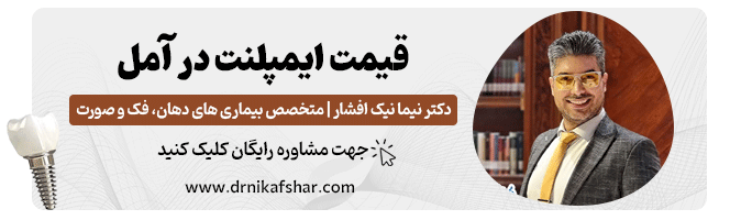 مشاهده قیمت ایمپلنت در آمل