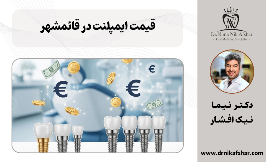 قیمت ایمپلنت دندان در قائمشهر