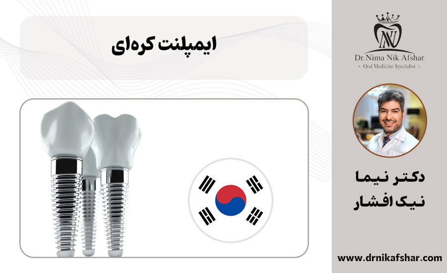 بهترین برند ایمپلنت کره‌ای + قیمت