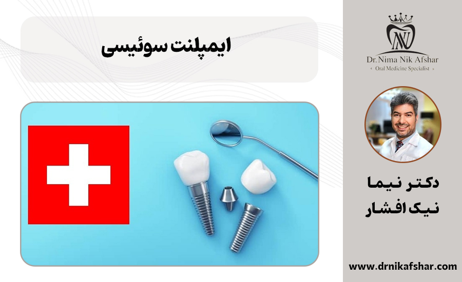 بهترین برند ایمپلنت سوئیسی