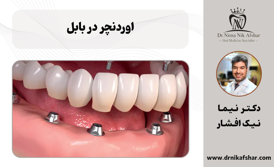 اوردنچر در بابل