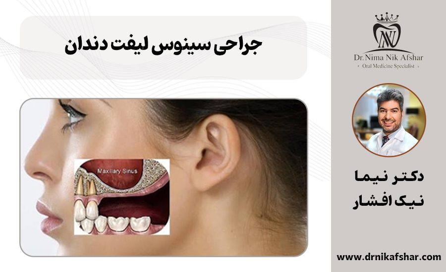 جراحی سینوس لیفت دندان چیست؟
