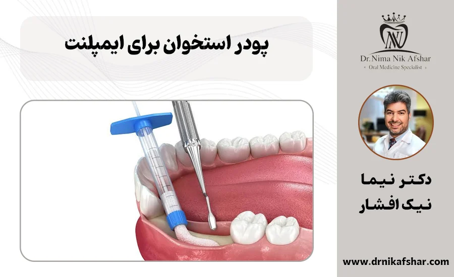 پودر استخوان برای ایمپلنت
